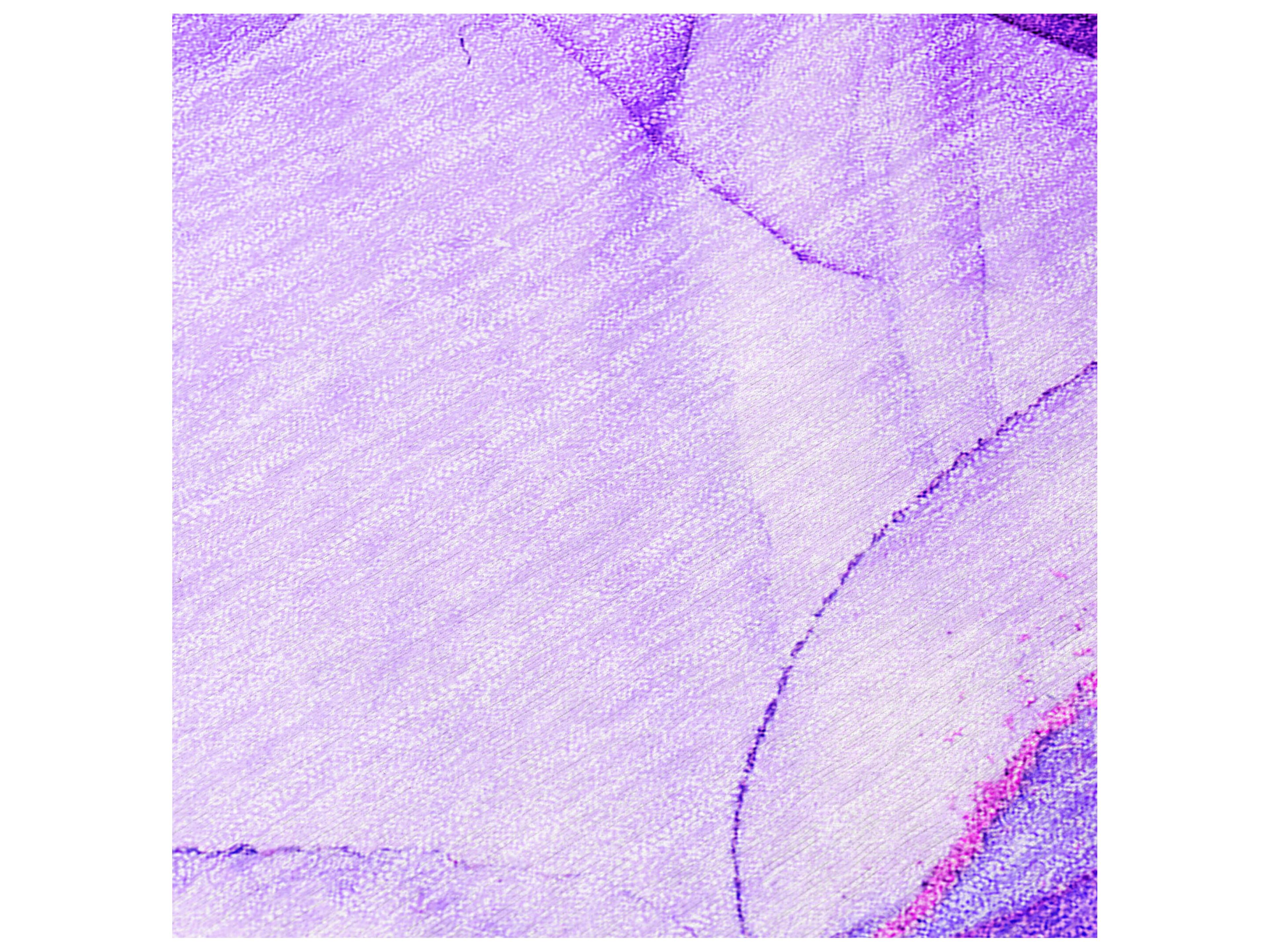 Dalyn Chantille Round Area Rug