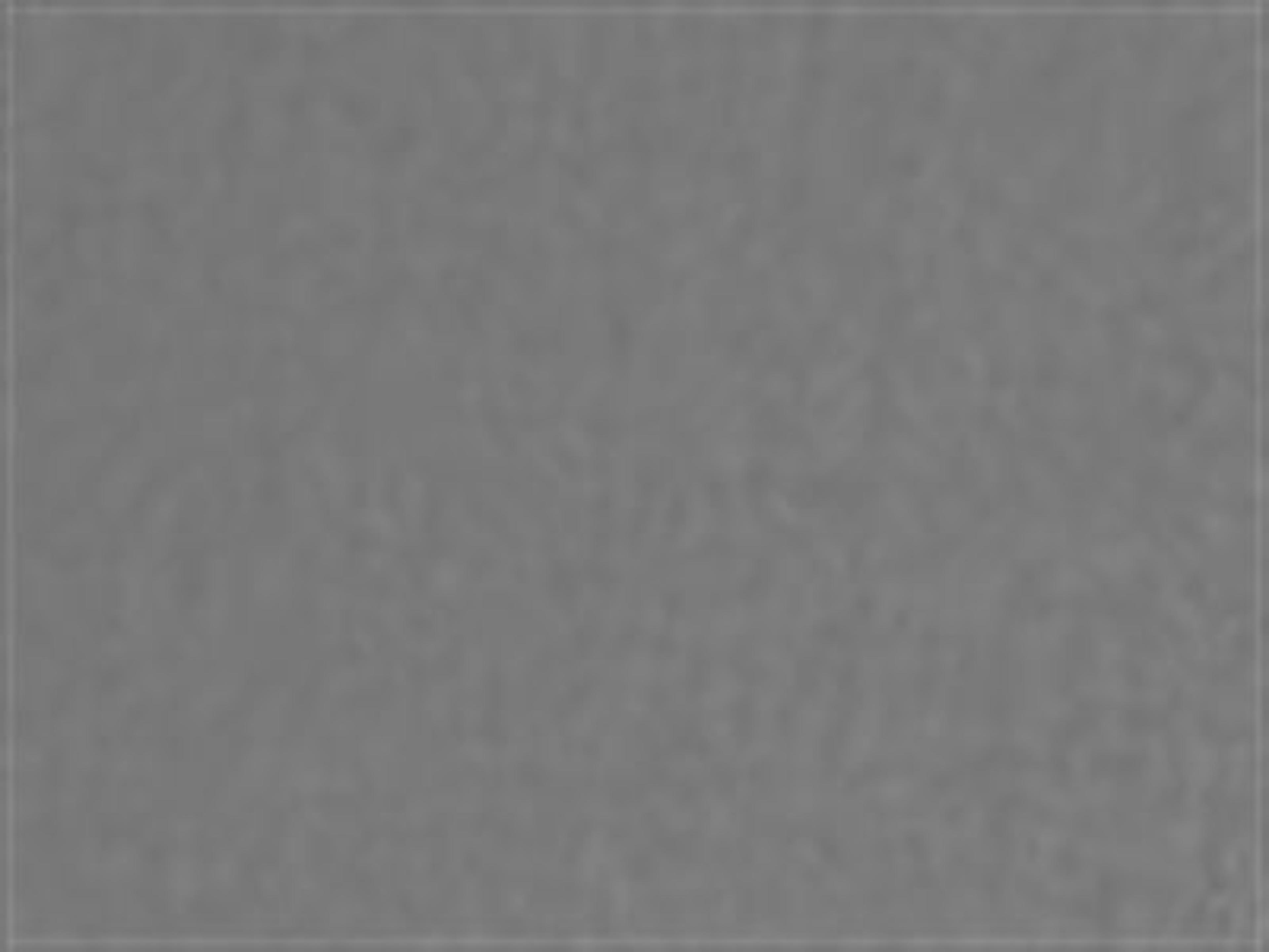 Umbrella Fabric: Anthracite