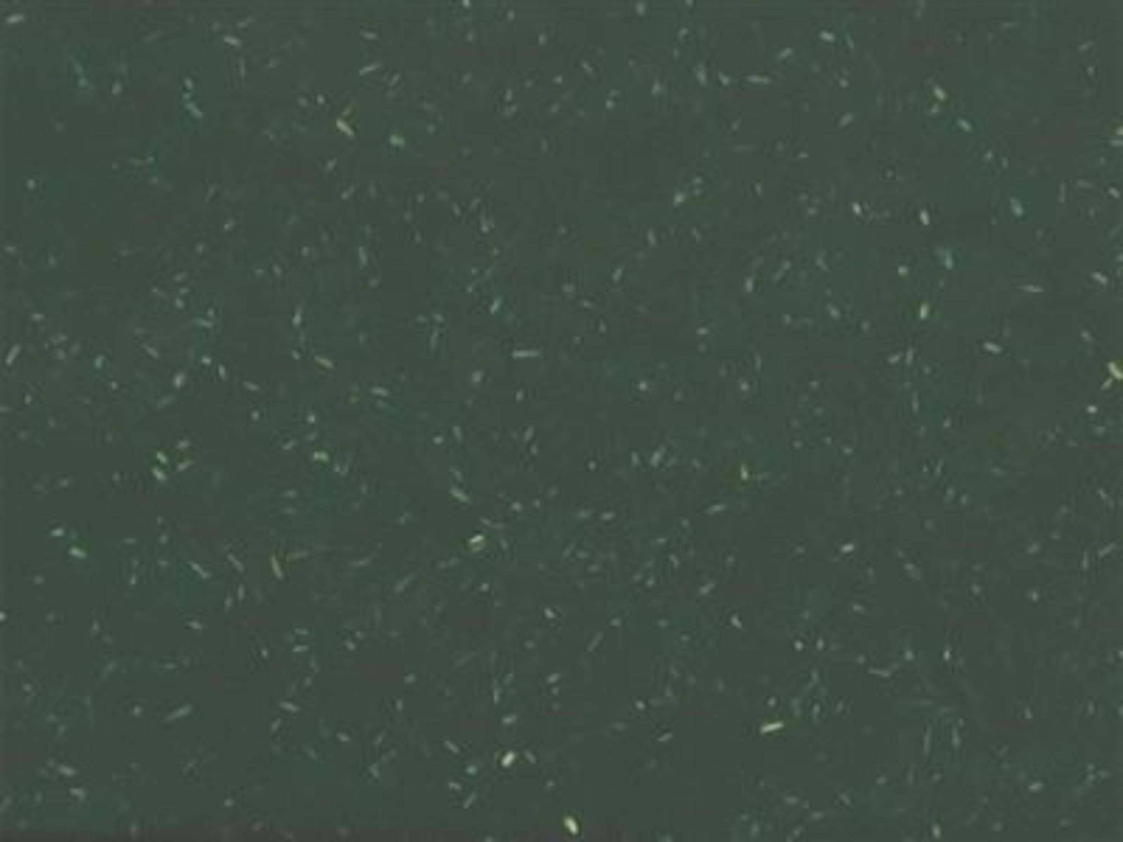 Frame Finish: Green- Recycled Pet