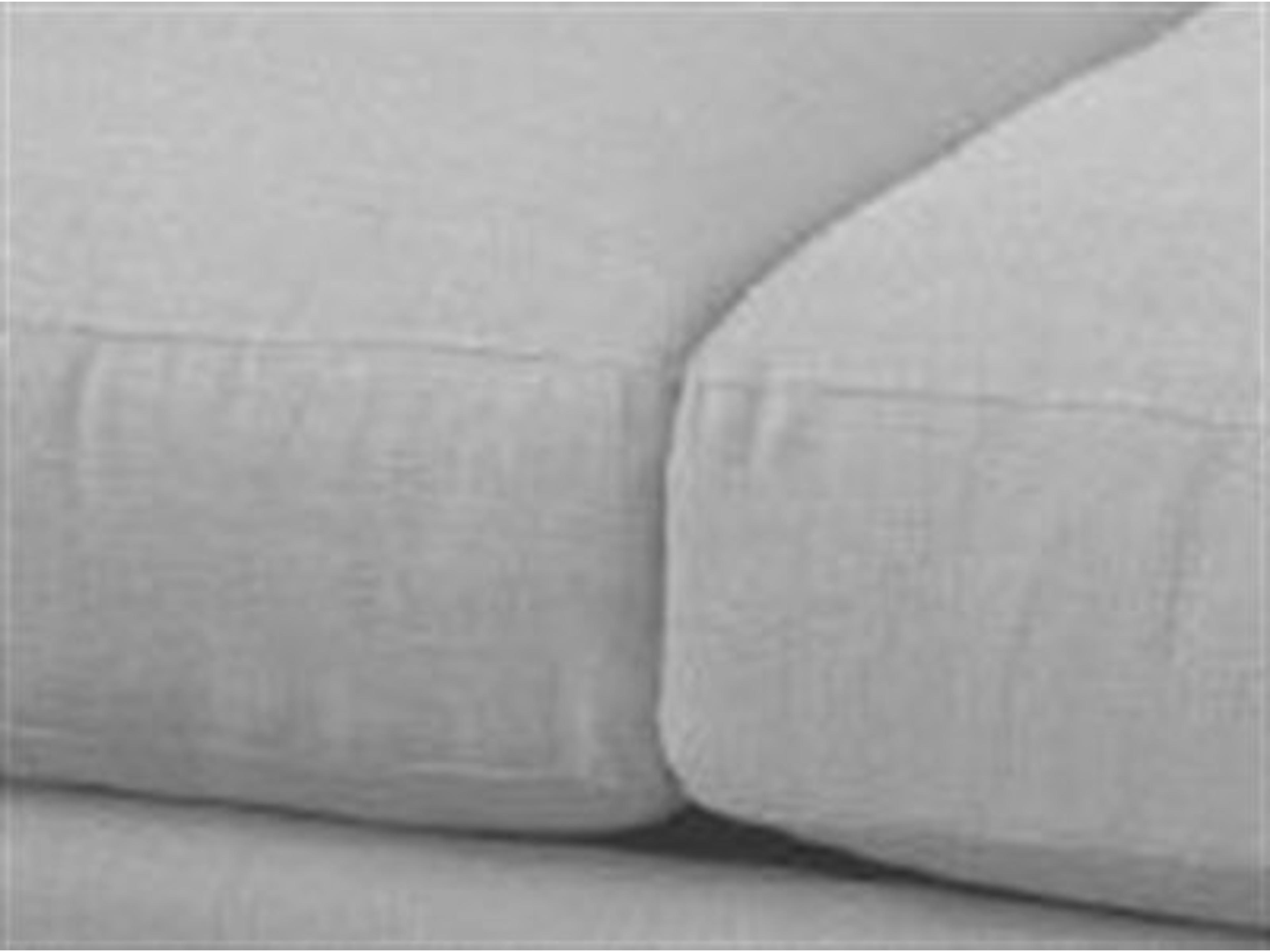 Tailoring Treatment: Unwelted